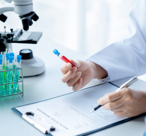 A laboratory assistant, a medical scientist, a chemistry researcher holds a test tube of chemicals and examines the disease from a patient's blood sample. Medicine and research concept.